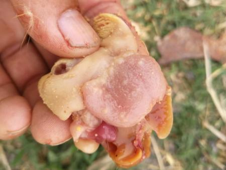 最新通报无症状感染的深度分析与论述